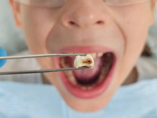 Best Pediatric Emergency Dentist in Orrville, OH